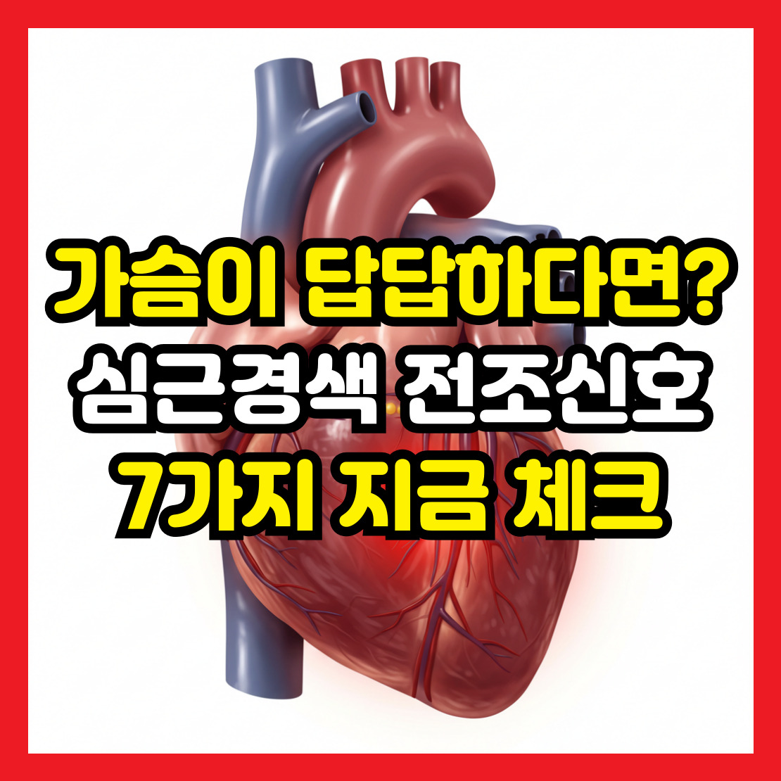 심근경색-전조신호