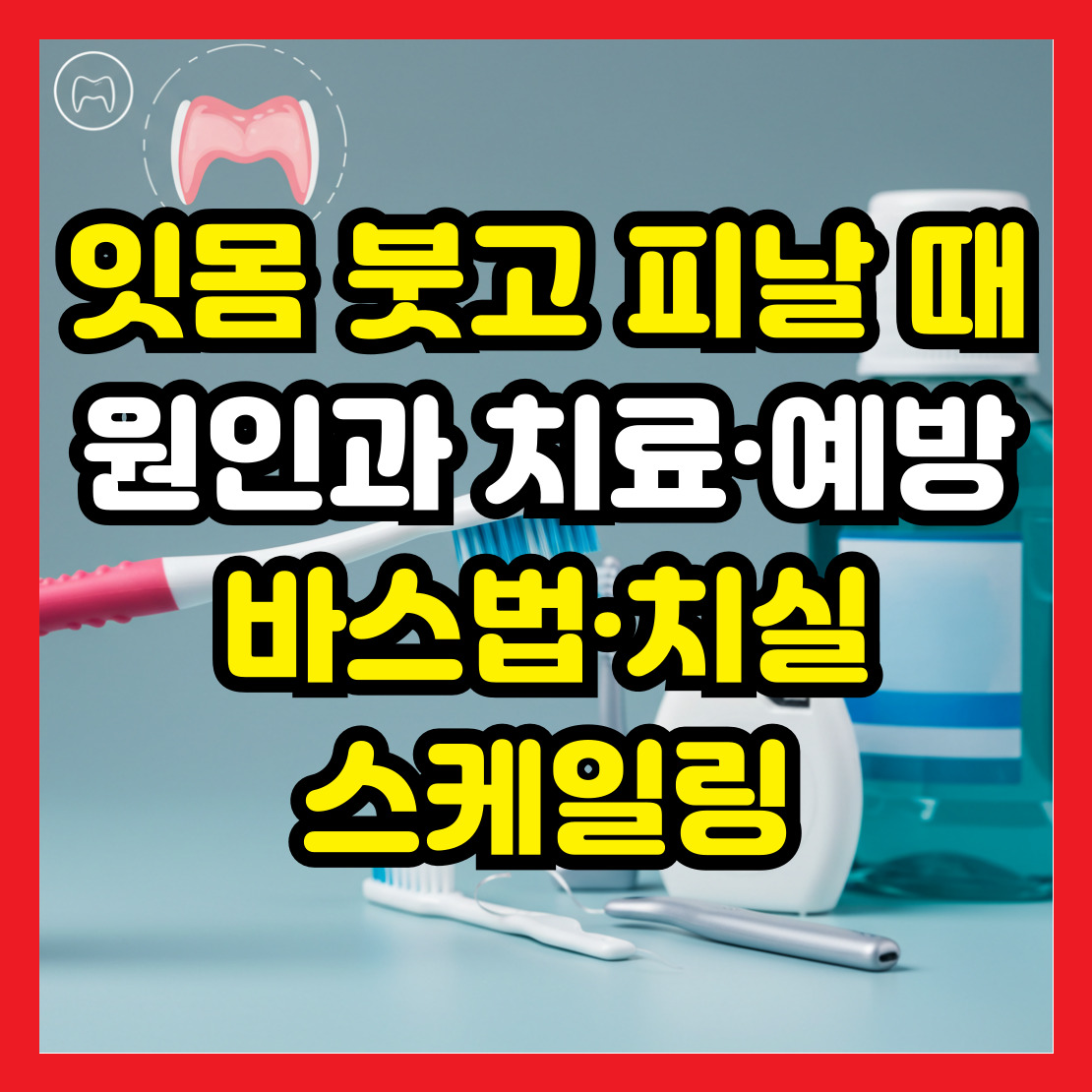 잇몸-붓고-피날-때